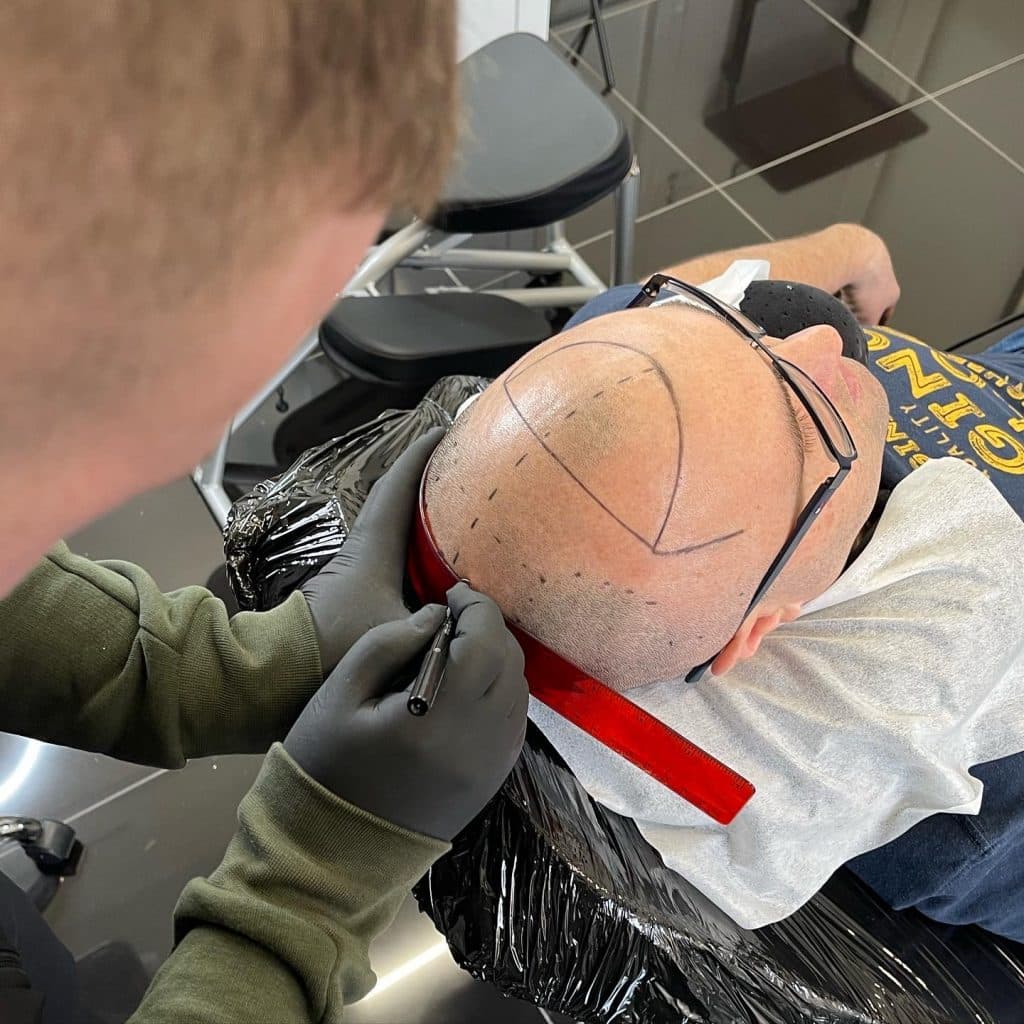 Scalp Micro-pigmentation Training
