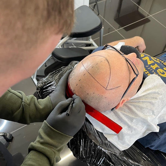 Scalp Micro-pigmentation Training